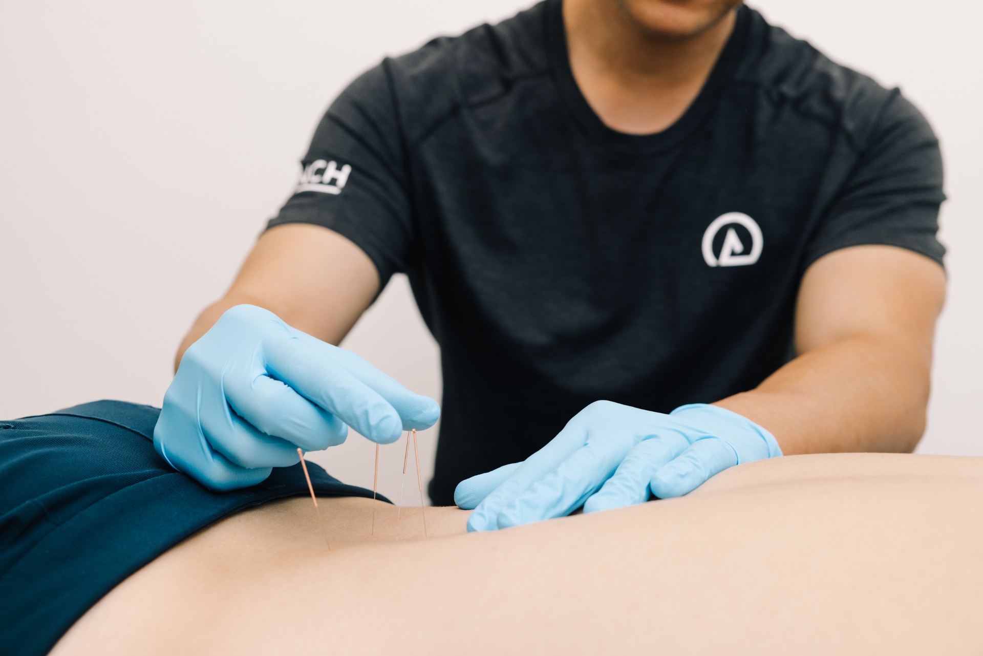 Launch Rehab Acupuncture / IMS / Dry Needling